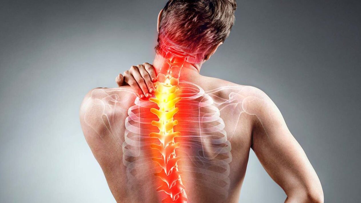 simptomi hrbtenične osteohondroze